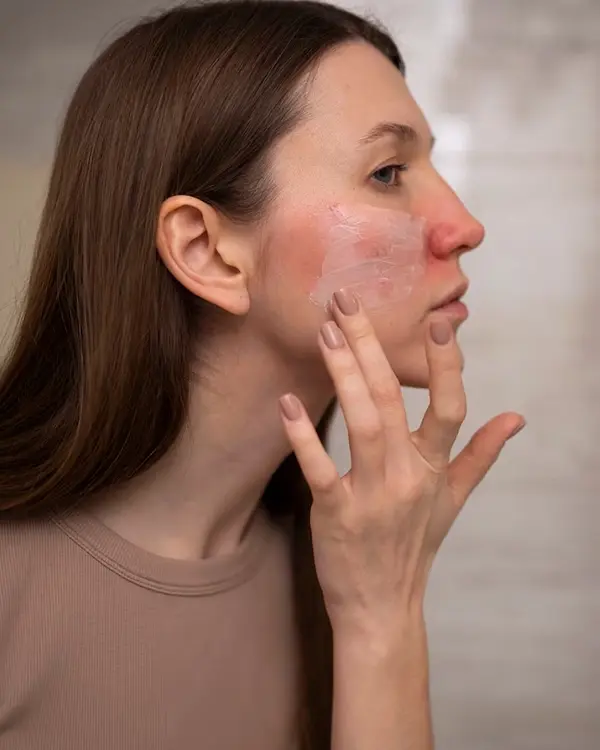 Facial Injuries