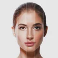 Dermatology