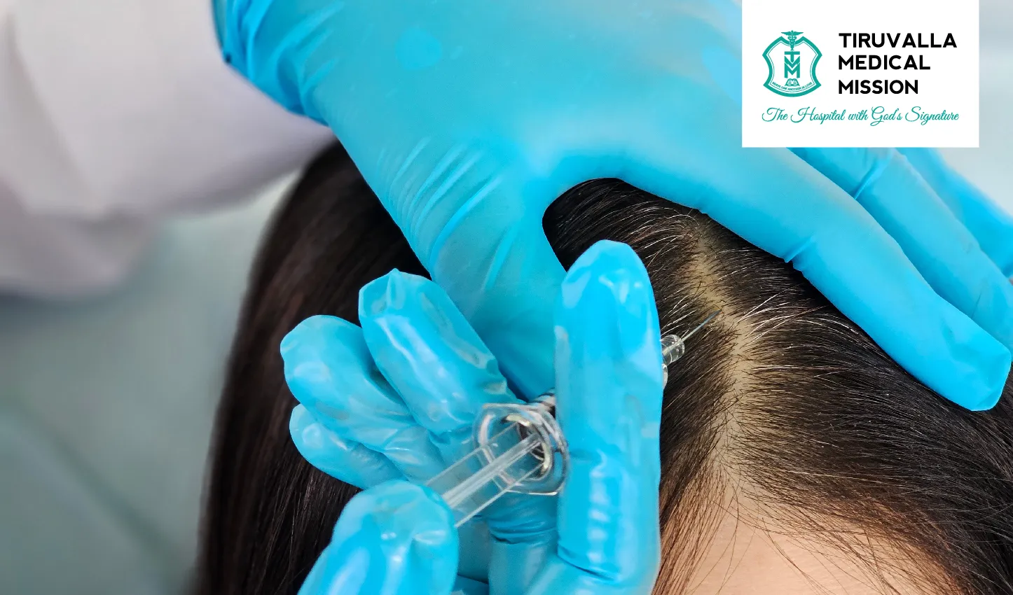 Restoring Confidence: How PRP and GFC Help Treat Hair Loss Naturally